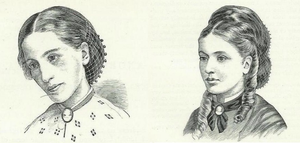 'Miss A' met anorexia in 1866 en 1870, voor en na de behandeling van William Withey Gull 