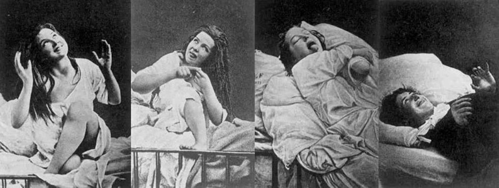 Foto's van vrouwen met hysterie (onder hypnose), in een 19e eeuws ziekenhuis in Parijs.